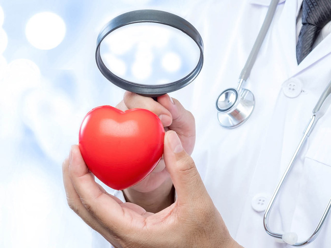 Những câu hỏi thường gặp về sức khỏe tim mạch và lời giải đáp đến từ chuyên gia - Ảnh 4