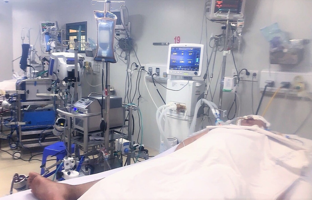 Một bệnh nhân Covid-19 nặng được chuyển từ Sóc Trăng lên điều trị ECMO tại Bệnh viện Bệnh Nhiệt đới TP.HCM trong tình trạng nguy kịch. Ảnh: BVCC.