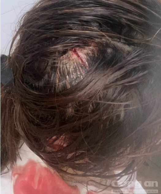 Thiếu nữ 16 tuổi bị chủ tiệm spa đánh bầm mắt, cắt tóc rồi đăng lên mạng - Ảnh 3