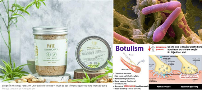 Chuyên gia đánh giá vi khuẩn Clostridium botulinum liên quan đến thực phẩm pate Minh Chay là chất độc thần kinh cực mạnh - Ảnh 2