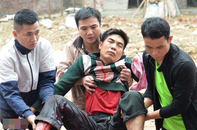 Bắc Ninh: Đầu đạn phát nổ, một nam thanh niên bị thương - Ảnh 1