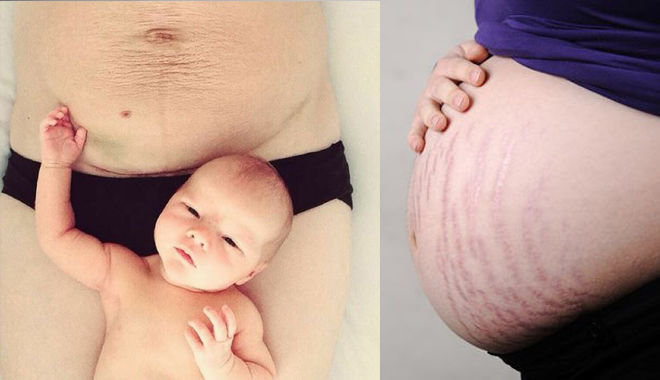 6 cách thay đổi đáng ngạc nhiên của cơ thể bạn sau khi mang thai - Ảnh 3