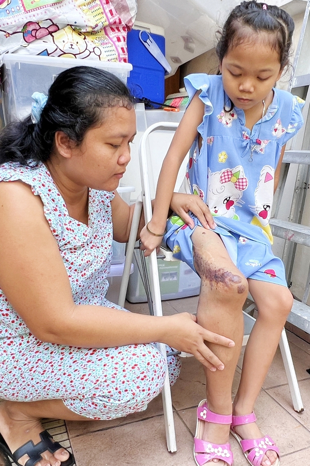 Hy vọng mong manh của bé gái 9 tuổi có thể mất đôi chân nếu không được chữa trị - Ảnh 3