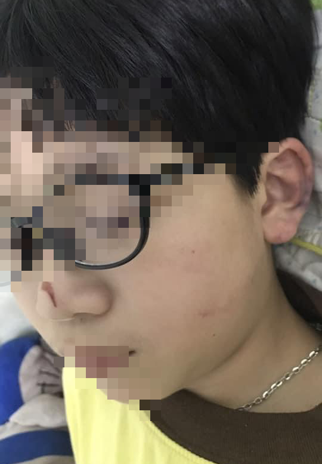 Bé trai 8 tuổi bị mẹ đánh bầm tím khắp người ở Quảng Ninh: Tiết lộ nguyên nhân bất ngờ - Ảnh 2