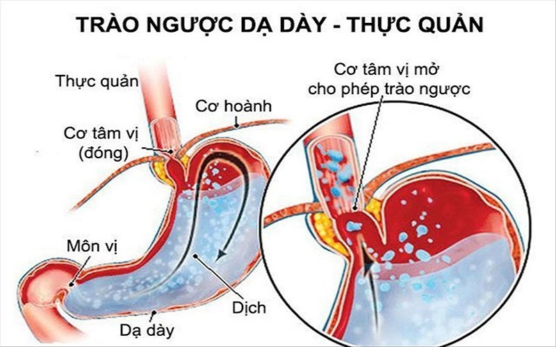 Căn bệnh khiến Hà Tăng ngày càng gầy, có nguy cơ biến chứng cao, nhiều người dễ mắc phải - Ảnh 4