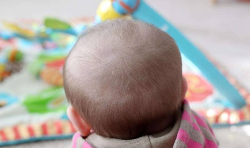 Tại sao một số trẻ sơ sinh có tóc dày và một số khác lại thưa thớt? Các bậc phụ huynh nên lưu ý những điều này - Ảnh 2