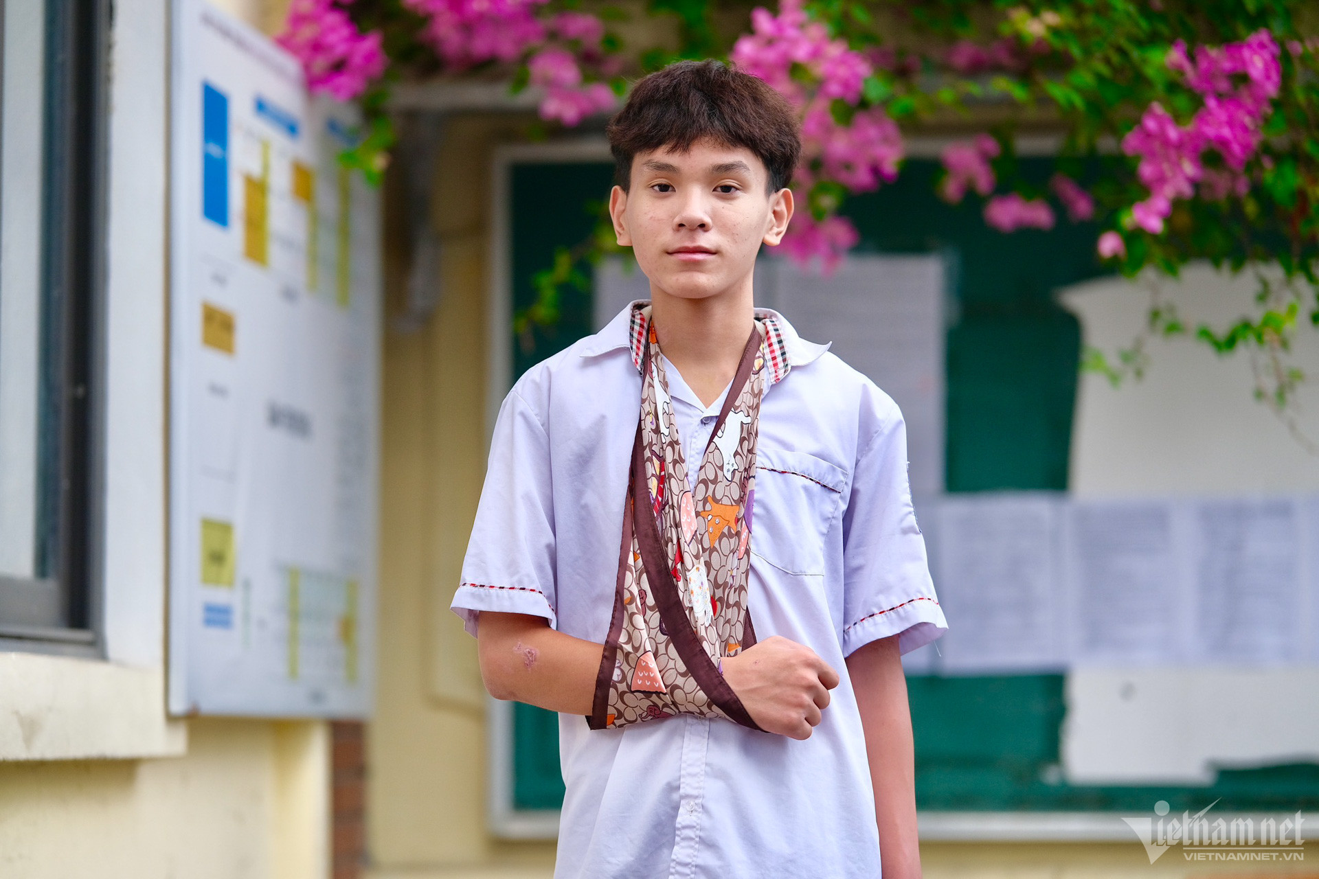 Nghị lực của các thí sinh 'đặc biệt' vào lớp 10 ở Hà Nội: Người nén đau dự thi, người được bố trí học sinh khác chép bài hộ - Ảnh 2
