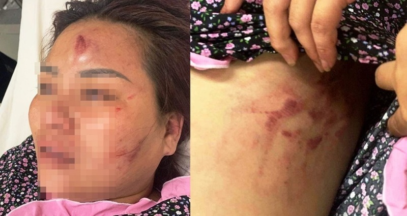 Luật sư tố cáo tội ác dã man của người chồng đánh vợ ở Đà Nẵng: Pháp không dung, đời không tha - Ảnh 2