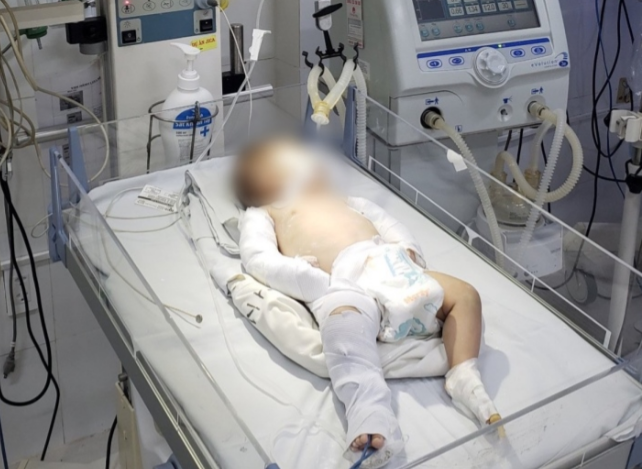 Diễn biến sức khỏe mới nhất của bé gái 3 tháng tuổi bị người tình của mẹ bạo hành ở Đà Lạt - Ảnh 2