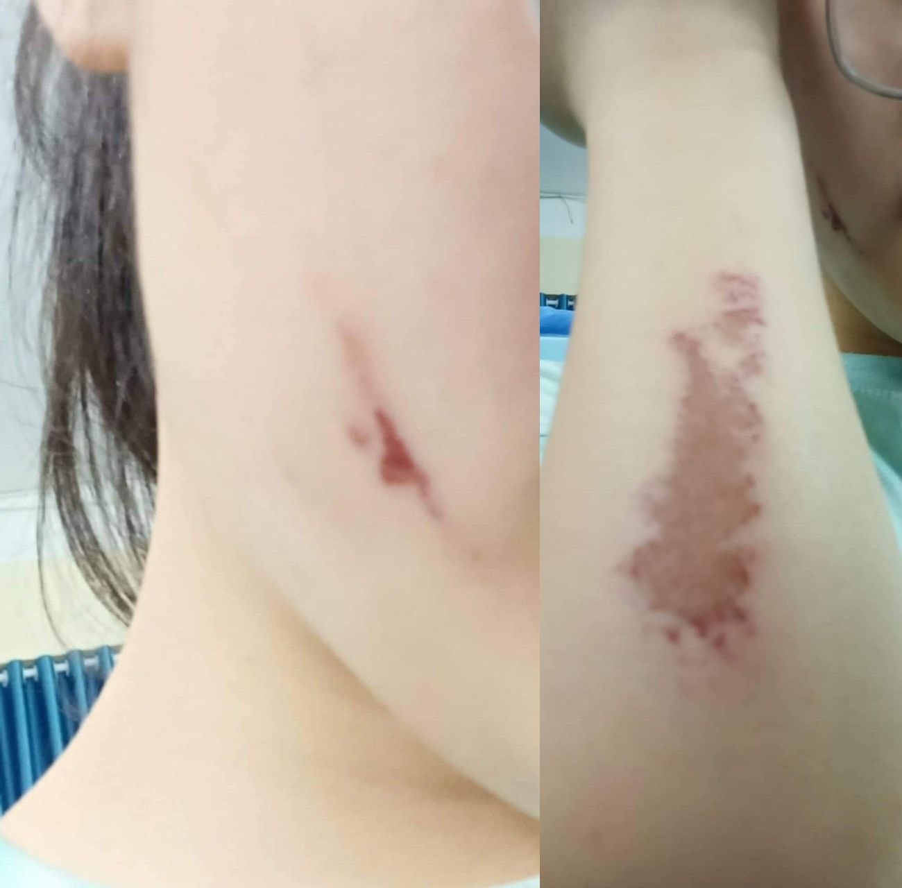 Phát hiện một nữ sinh bị đánh trầy trật và đe dọa trong phòng nội trú: gia đình bất ngờ vì trường không tố cáo - Ảnh 1