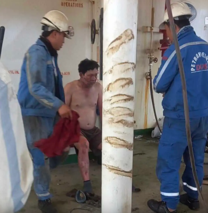 Nổ bình khí gas ở Nhà máy đóng tàu Dung Quất làm 9 người bị bỏng: Có 3 nạn nhân đang nguy kịch - Ảnh 3