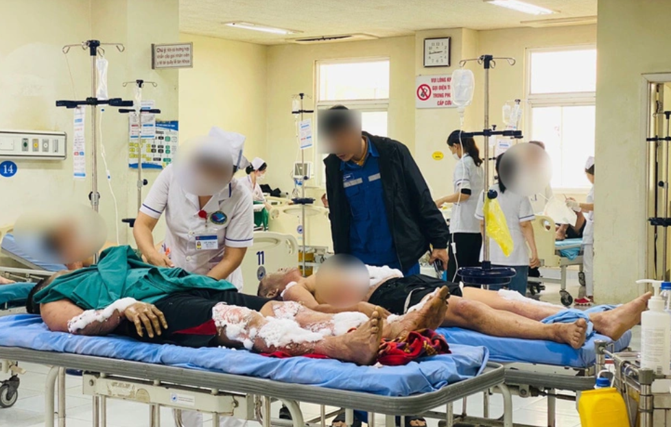 Nổ bình khí gas ở Nhà máy đóng tàu Dung Quất làm 9 người bị bỏng: Có 3 nạn nhân đang nguy kịch - Ảnh 2