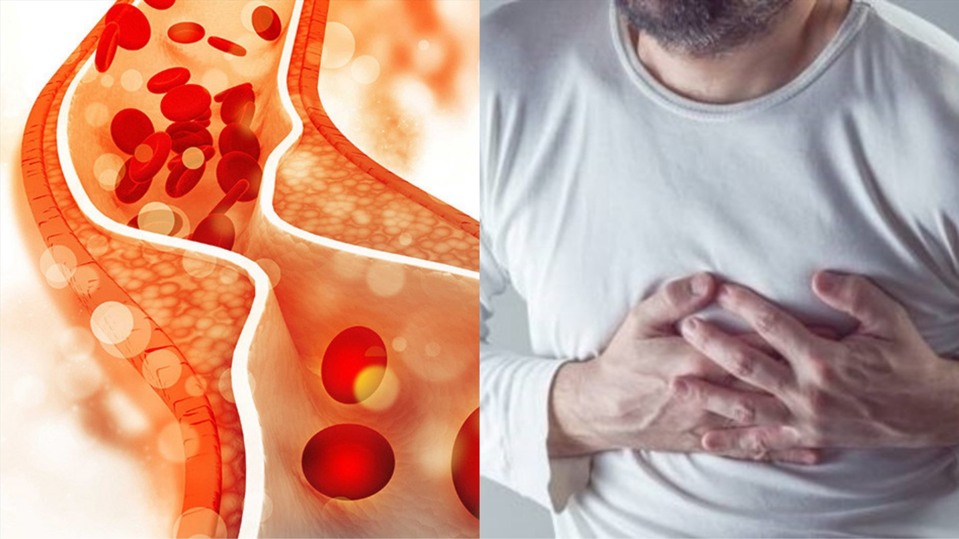 Cholesterol tăng cao : Đừng để biến chứng của 'kẻ sát nhân' gây đau tim, đột quỵ  - Ảnh 1