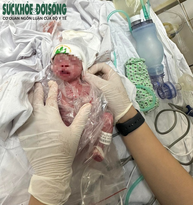 Phú Thọ: Bé sơ sinh nặng 800gr chào đời trong cơn tiền sản giật nặng của người mẹ U40, con sinh ở tuần thứ 30  - Ảnh 2