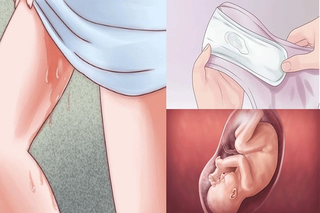 Làm thế nào để biết dấu hiệu bạn bị vỡ nước ối khi mang thai? - Ảnh 2