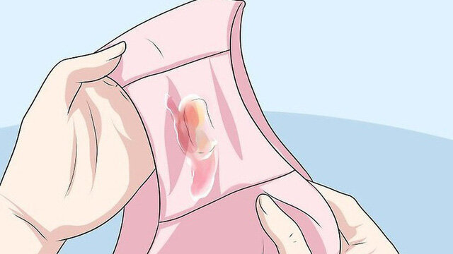 3 dấu hiệu tiết dịch âm đạo ngầm cảnh báo bệnh ung thư cổ tử cung mà nữ giới thường chủ quan bỏ qua - Ảnh 1