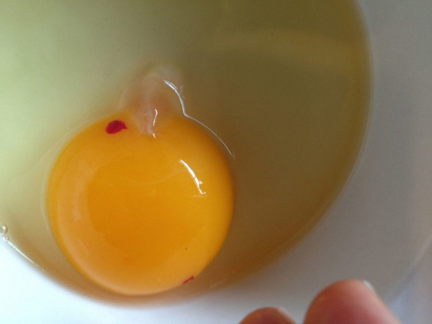 4 kiểu trứng hỏng gây hại cho sức khỏe nhưng nhiều người vẫn tiếc rẻ mà cố ăn - Ảnh 3