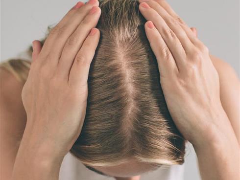 5 mẹo đơn giản để chăm sóc mái tóc mỏng!