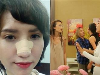 Thực hư chuyện Hồng Xuân rời Vietnam’s Next Top Model vì bị đánh gãy mũi tại nhà chung