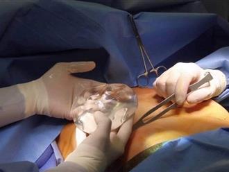 TP.HCM: Bác sĩ phẫu thuật thẩm mỹ 'lén lút' chở thi thể cô gái nâng ngực đến trại hòm