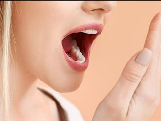 10 cách chữa trị hôi miệng tự nhiên tại nhà