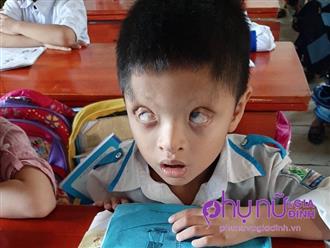 Nghị lực sống phi thường và khát vọng đến trường của cậu bé 6 tuổi có đôi mắt chỉ nhìn thấy 2% ánh sáng