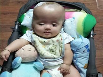 Hạnh phúc vỡ òa của cặp vợ chồng trẻ sau hơn 4 tháng cùng con trai mắc não úng thủy giành giật sự sống tại Singapore