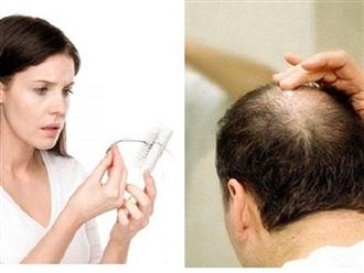 Bạn có biết rụng tóc nhiều là do thiếu chất gì hay không?