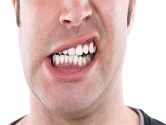 Cách chữa nghiến răng khi ngủ dân gian như thế nào cho hiệu quả?