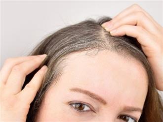 Tìm hiểu nguyên nhân tóc bạc sớm ở người trẻ tuổi