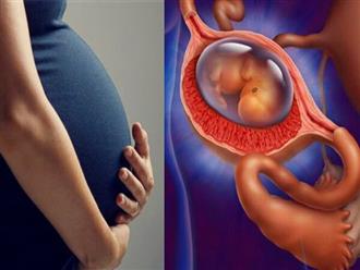 Mang thai ngoài tử cung có sinh được không?