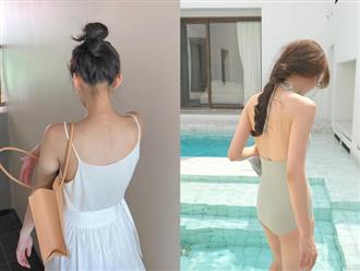 3 tips giúp bạn đánh bay mụn lưng để thỏa sức diện bikini hè này