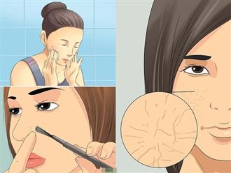 Nếu không muốn da mặt nhăn nheo, sần sùi ở tuổi 25, tuyệt đối tránh xa 5 thói quen này