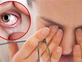 Phê duyệt thuốc xịt mũi đầu tiên trị bệnh khô mắt