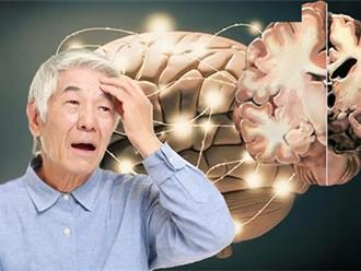 Giảm chứng mất trí nhớ của bệnh Alzheimer với thuốc trị đa xơ cứng