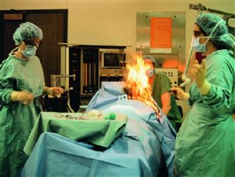 Bệnh nhân tự bốc cháy, bỏng nặng khi đang trong phòng phẫu thuật, nguyên nhân chỉ vì một cú 'xì hơi'