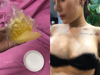 Em kết nghĩa của ca sĩ Quách Tuấn Du bị vỡ túi ngực 2.000 USD trên máy bay, bác sĩ thẩm mỹ biến mất