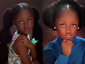 Cô bé Châu Phi sở hữu nhan sắc phá vỡ mọi quy chuẩn về cái đẹp của thế giới gây tiếc nuối với nhan sắc hiện tại