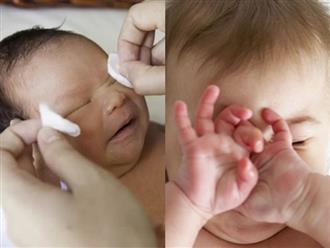 Hiểm họa khôn lường từ cách chữa ghèn mắt cho trẻ sơ sinh bằng sữa mẹ