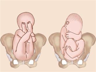 Tại sao có những thai nhi mãi không chịu quay đầu?