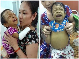 Tưởng tắm nắng chữa vàng da cho con sơ sinh, mẹ Việt rụng rời khi nghe bác sĩ kết luận