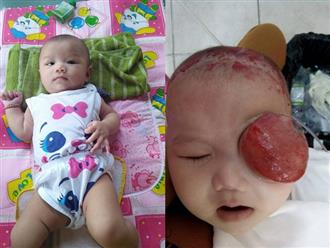 Xót xa bé gái 4 tháng tuổi ung thư hốc mắt, cha mẹ nghèo dốc cạn tài sản chạy chữa cho con