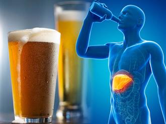 Không uống rượu bia bạn vẫn bị gan nhiễm mỡ: Nguyên nhân do đâu và cách phòng ngừa là gì? 