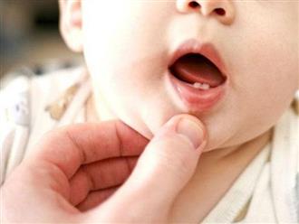 4 chất cần thiết trong quá trình mọc răng của trẻ, mẹ nên biết còn bổ sung đủ cho con