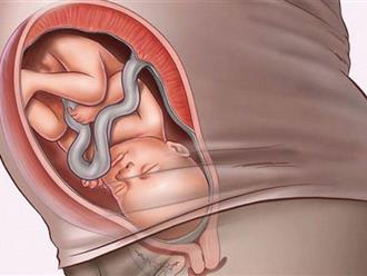 Vị trí nằm của thai nhi trong bụng mẹ theo từng giai đoạn thai kỳ