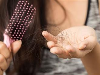 Top 6 cách trị rụng tóc hiệu quả tại nhà