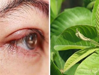 5 mẹo đơn giản giúp trị lẹo mắt, tạm biệt ngứa ngáy, bảo vệ thị lực