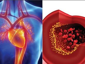 Cholesterol tăng cao: dấu hiệu của "kẻ giết người thầm lặng" đang tấn công tim và gây xơ vữa động mạch