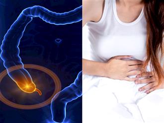 Đau ruột thừa: Những triệu chứng đáng báo động của bệnh viêm ruột thừa bạn không nên bỏ qua