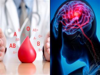 Phát hiện từ chuyên gia: Nhóm máu có thể dự đoán nguy cơ bị đột quỵ trước 60 tuổi, giảm thiểu yếu tố rủi ro